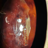 Plat vallauris