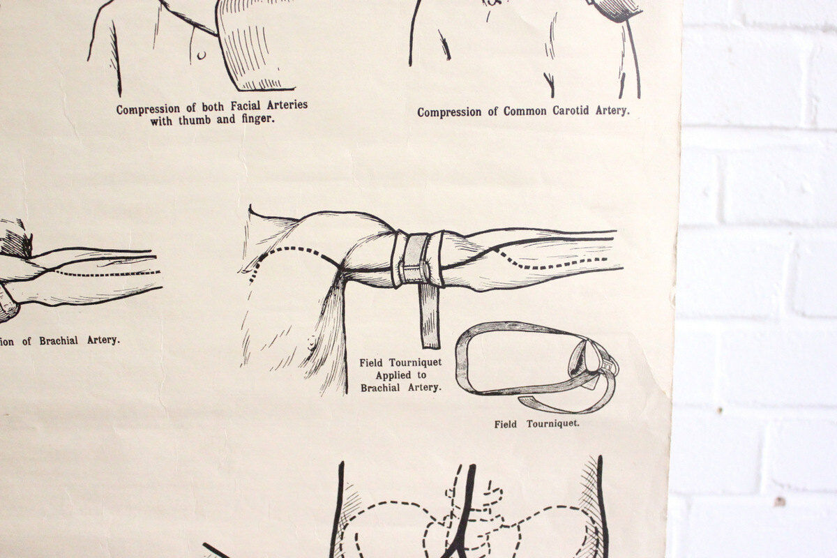 Displays educational anatomical bleeding
