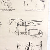 Displays educational anatomical bleeding