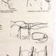 Displays educational anatomical bleeding