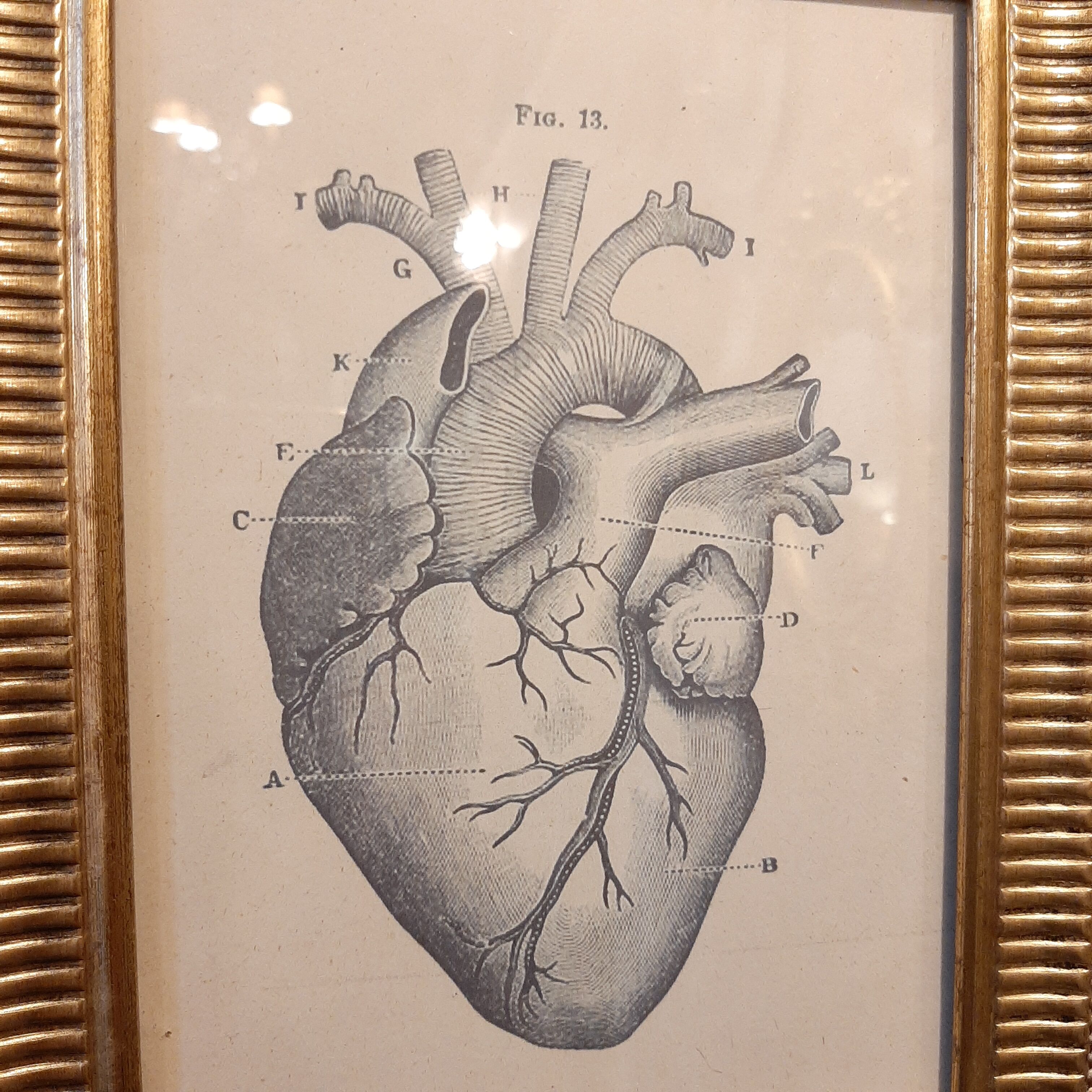 Anatomical heart frame