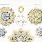 Poster about polycystic kidney stones, based on an old lithograph from 1904.