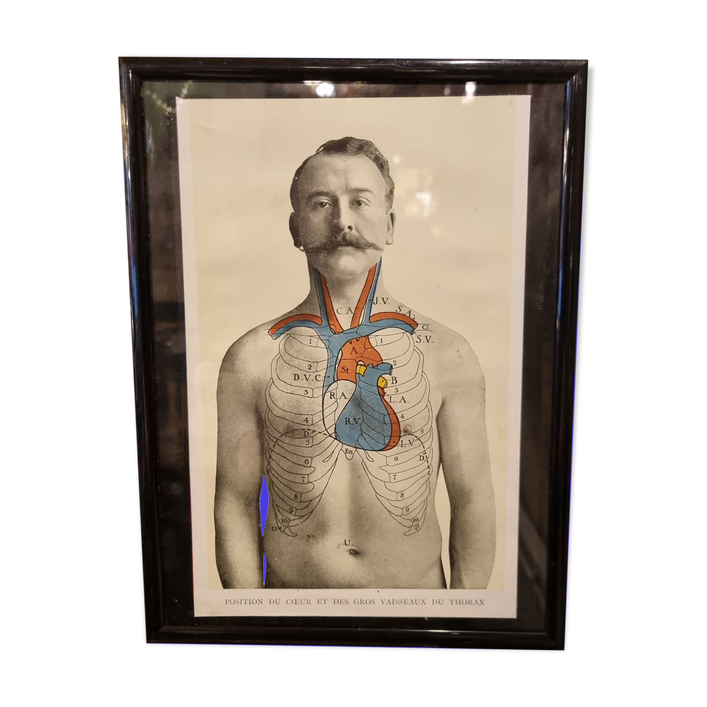 Photo frame book medicine