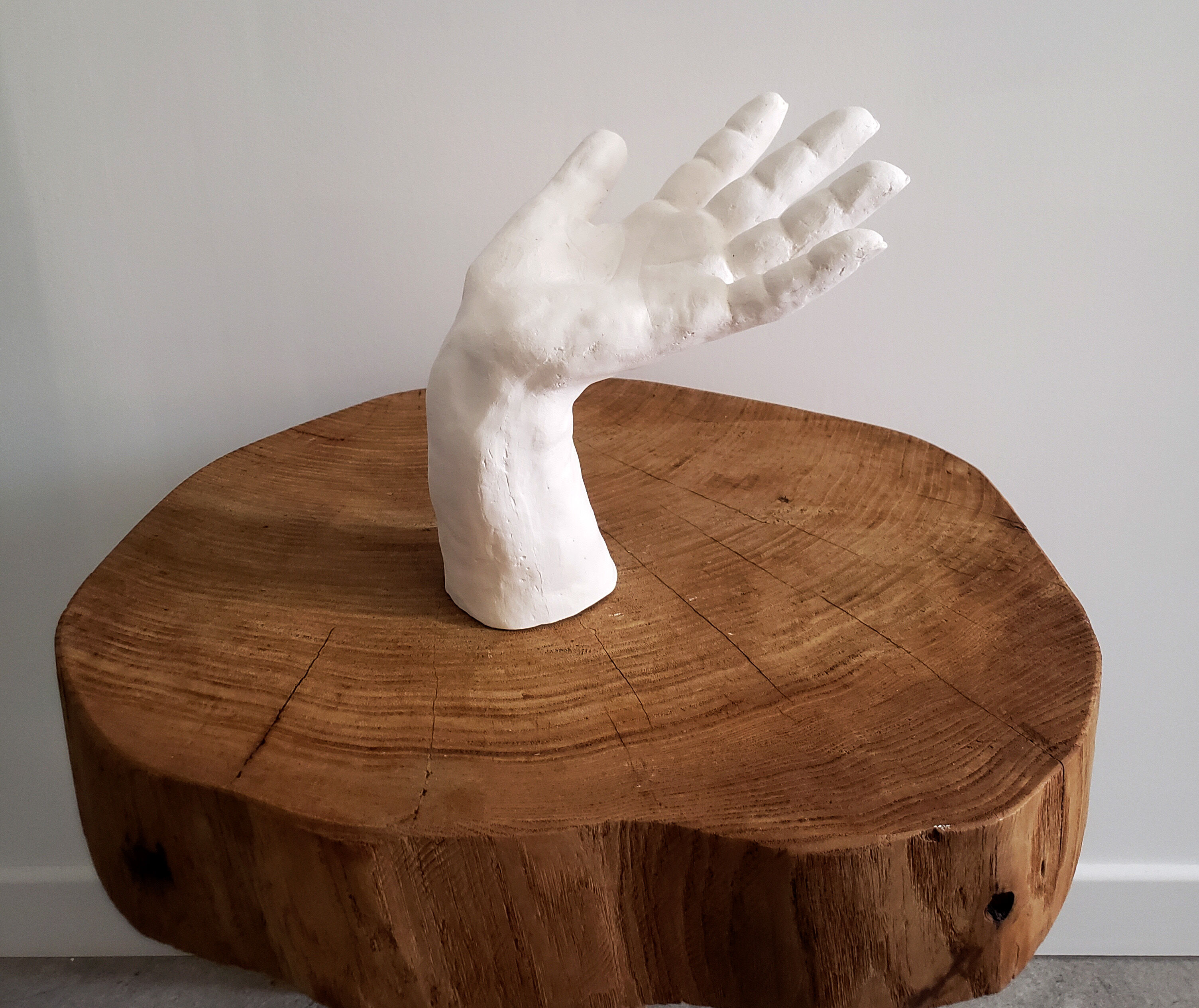 Plaster hand