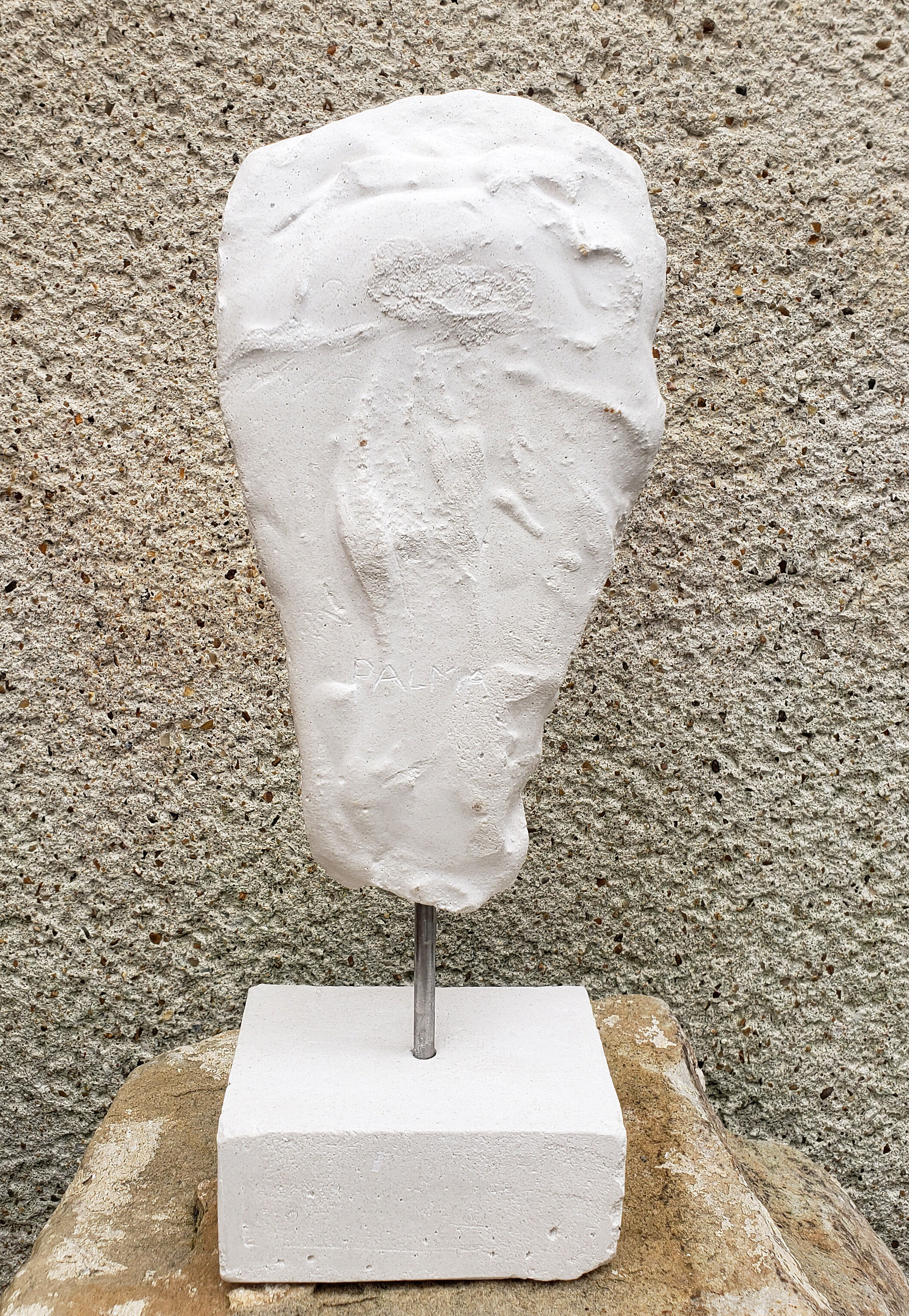 Young girl's head in plaster