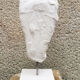 Young girl's head in plaster