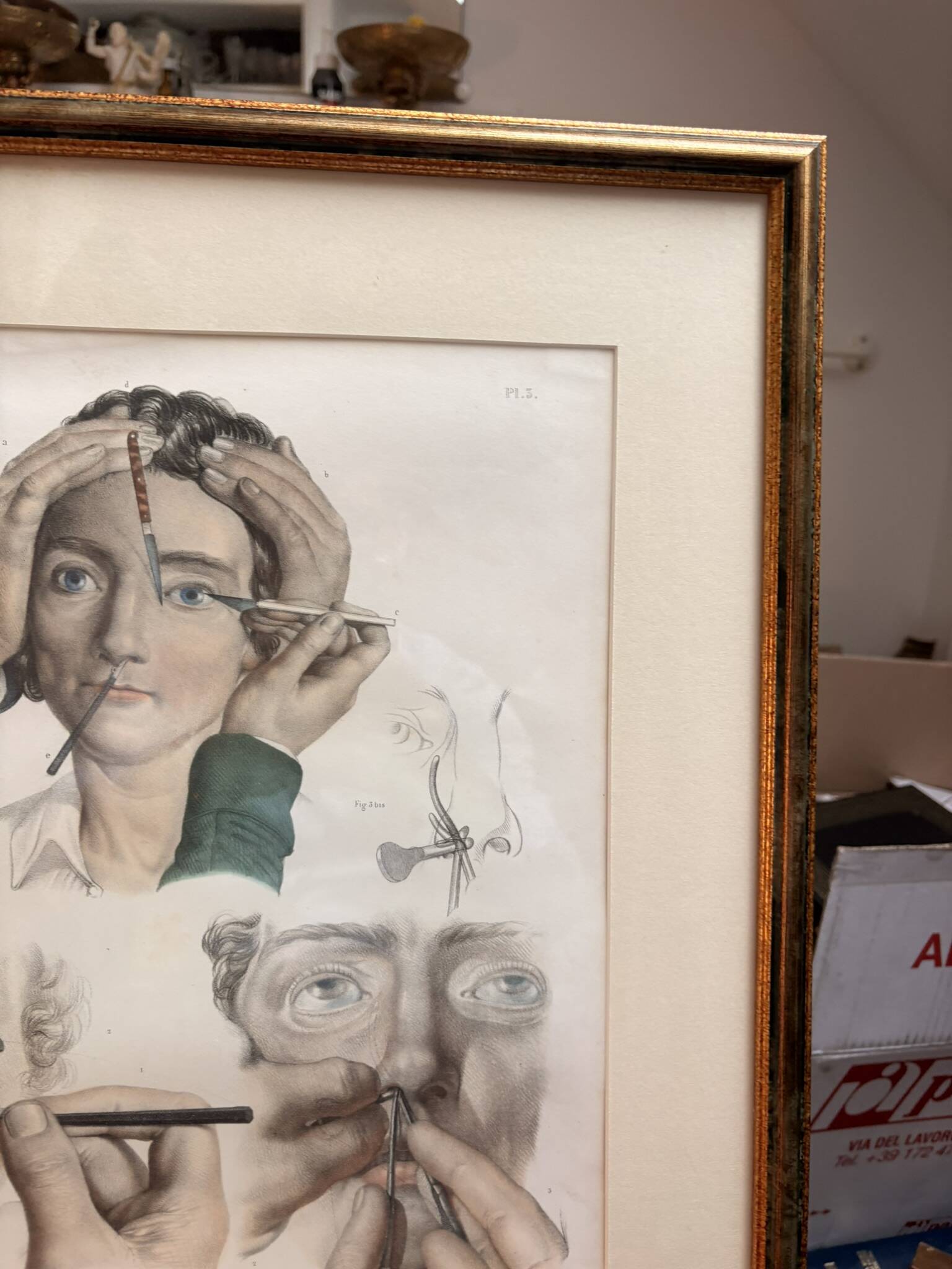 Old Print Engraving 19th Century Anatomy Surgery Atlas Bourgery Nicolas Jacob