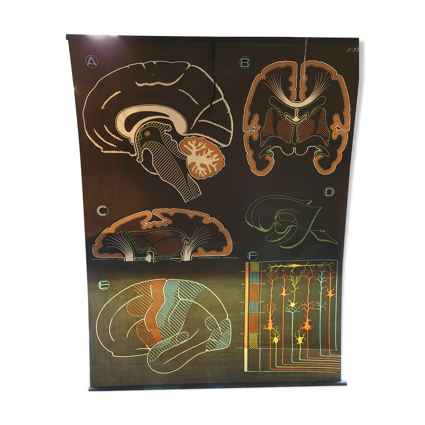 Pedagogical poster Doctor Auzoux 1949