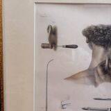 Print Engraving Material Surgery Seton Treatise Anatomy Man BOURGERY