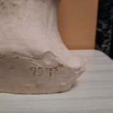 Boy's head in plaster