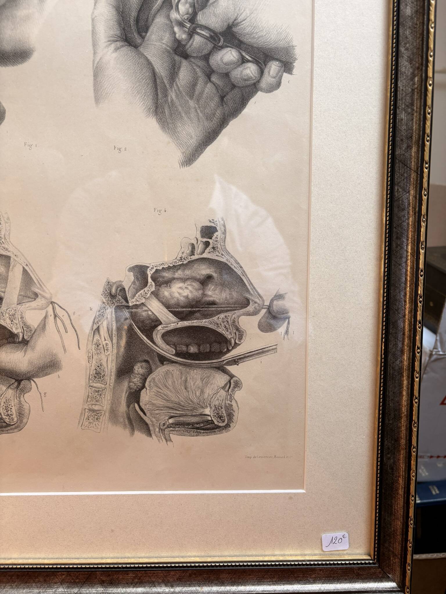 Old Engraving Nose Nasal Cavity NICOLAS HENRI Jacob Bourgery Medical Anatomy