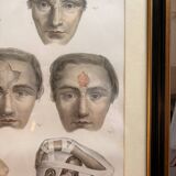 Gravure Plastic Surgery Rhinoplasty NICOLAS Jacob Bourgery Anatomy