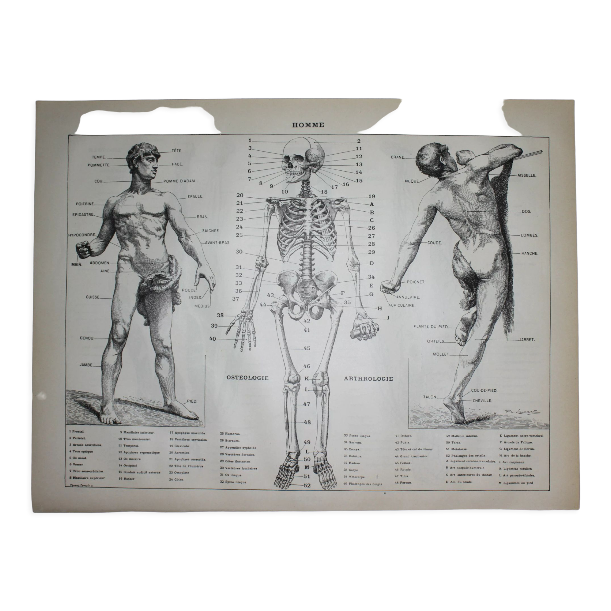Engraving • Human anatomy, medicine • Original lithograph from 1898