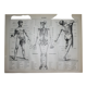 Engraving • Human anatomy, medicine • Original lithograph from 1898