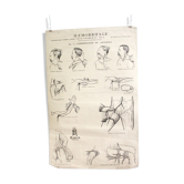 Displays educational anatomical bleeding