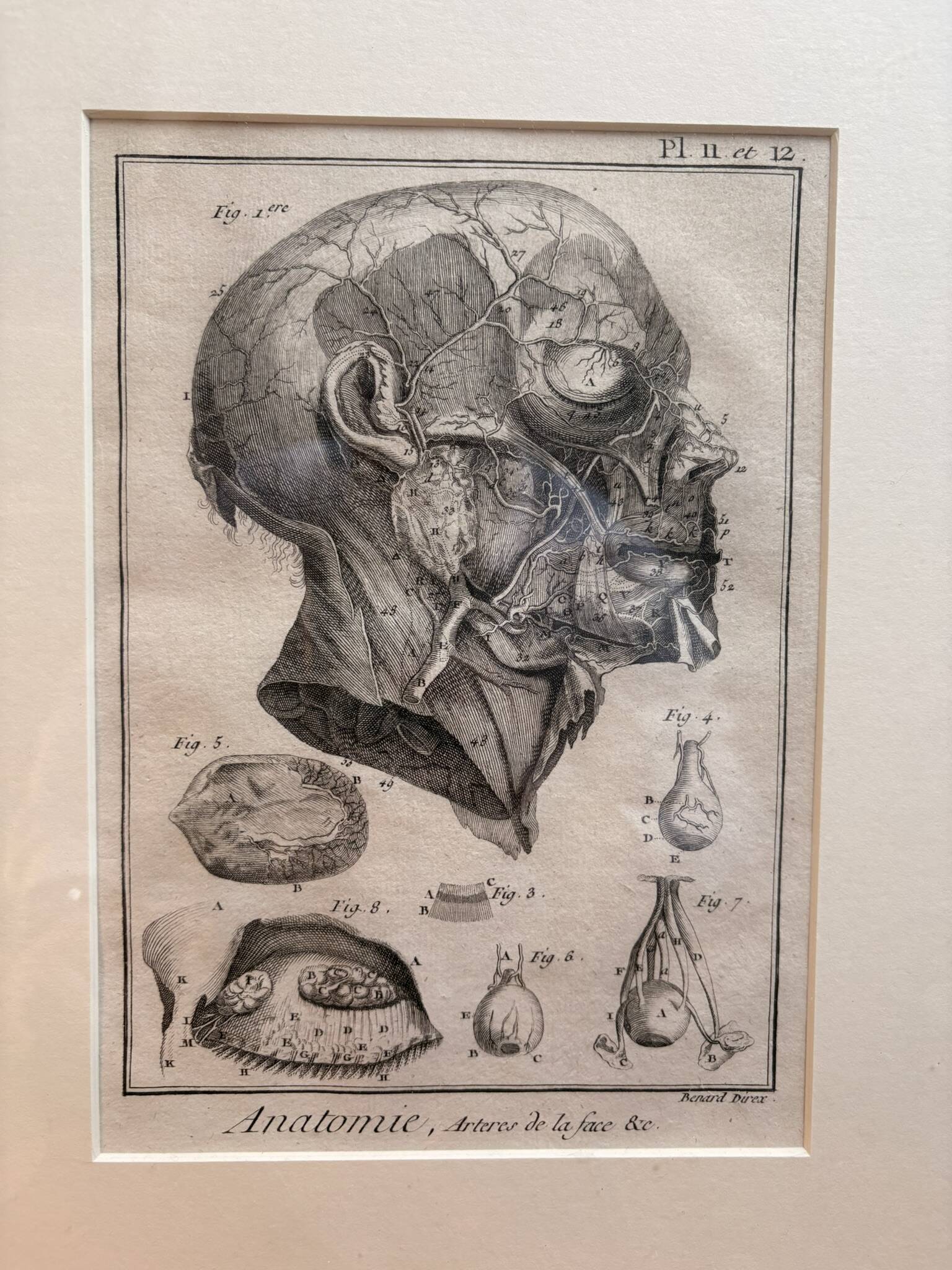 Old Print Engraving 19th Century Framed Anatomy Artery Face Bernard Dixerit
