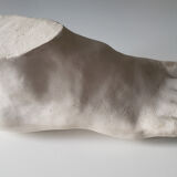 Plaster foot
