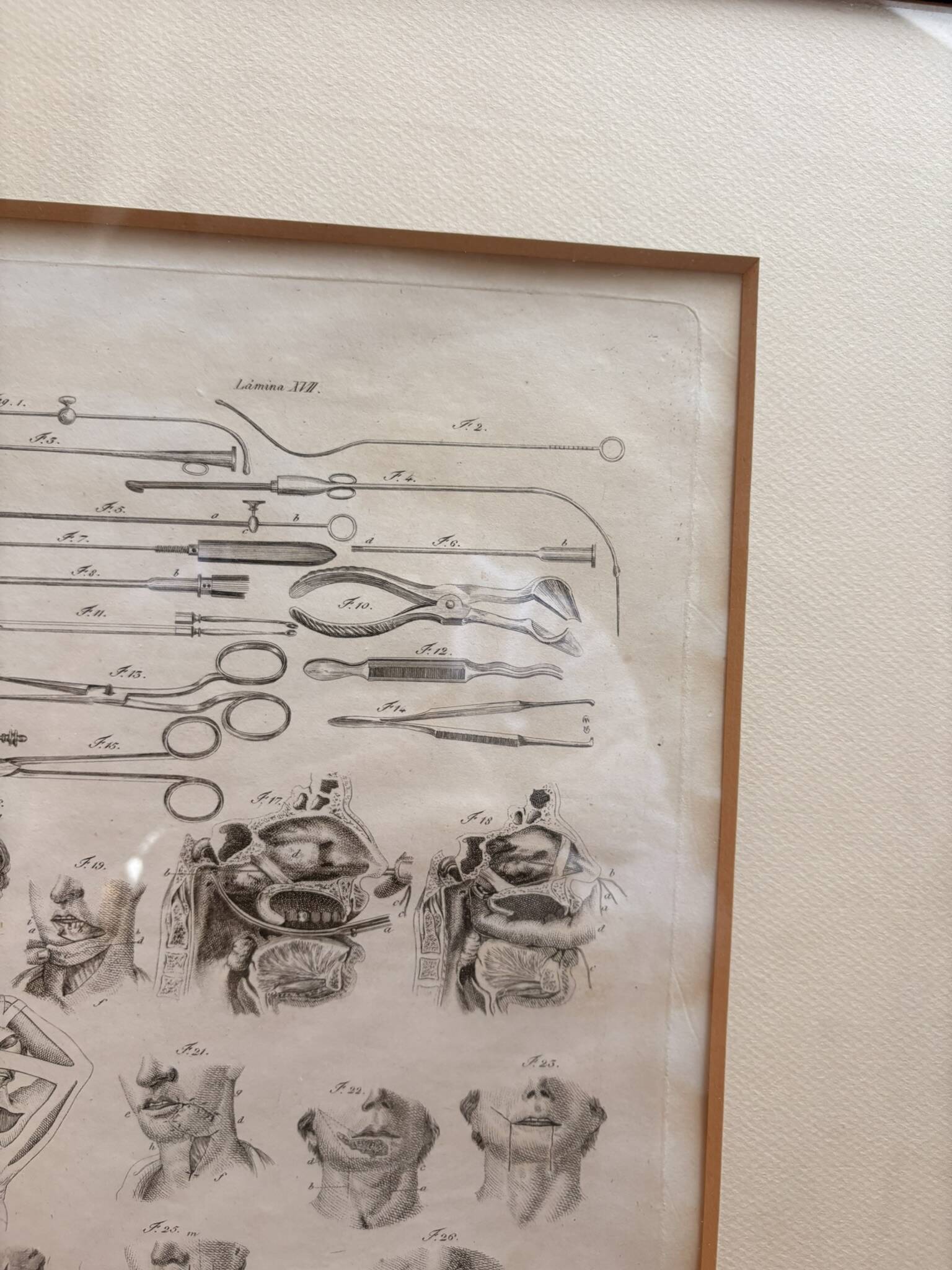 Engraving 19th century Nicolas Jacob Bourgery Medical instruments Anatomy Surgery