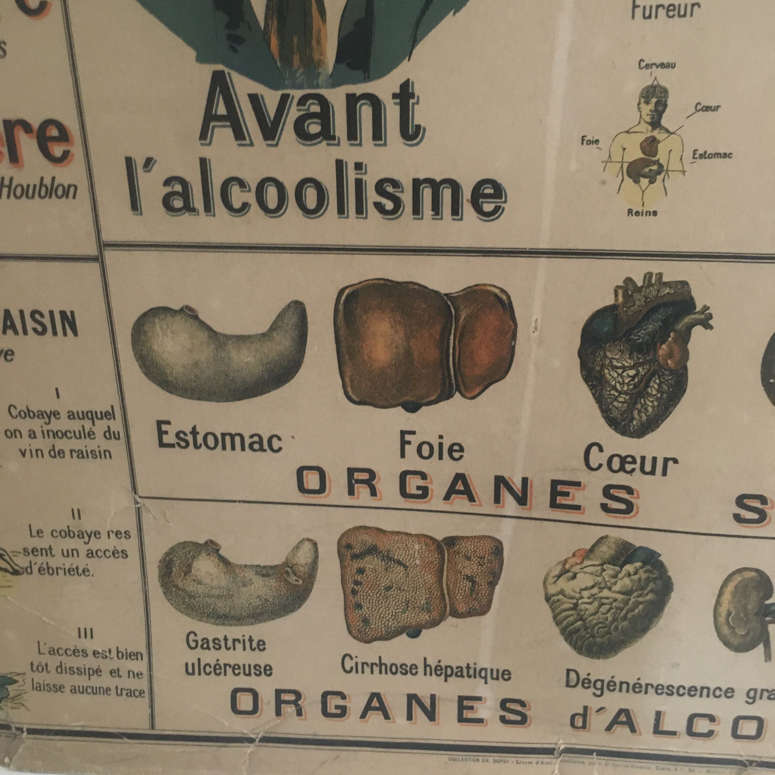 Educational panel "Alcohol is the enemy" 1910