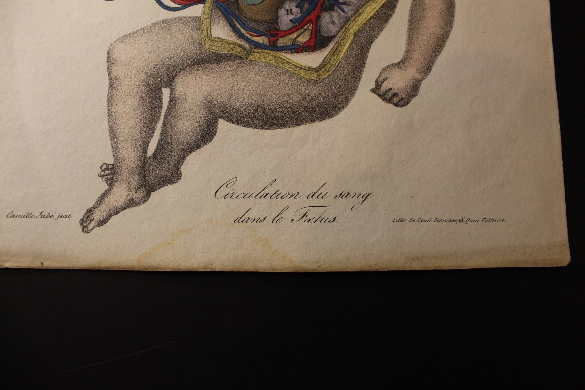 Planche médicale anatomie "circulation du sang dans le foetus"