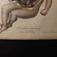 Medical anatomy board "Circulation of blood in the Foetus"