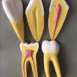 Large size dental model 3 teeth