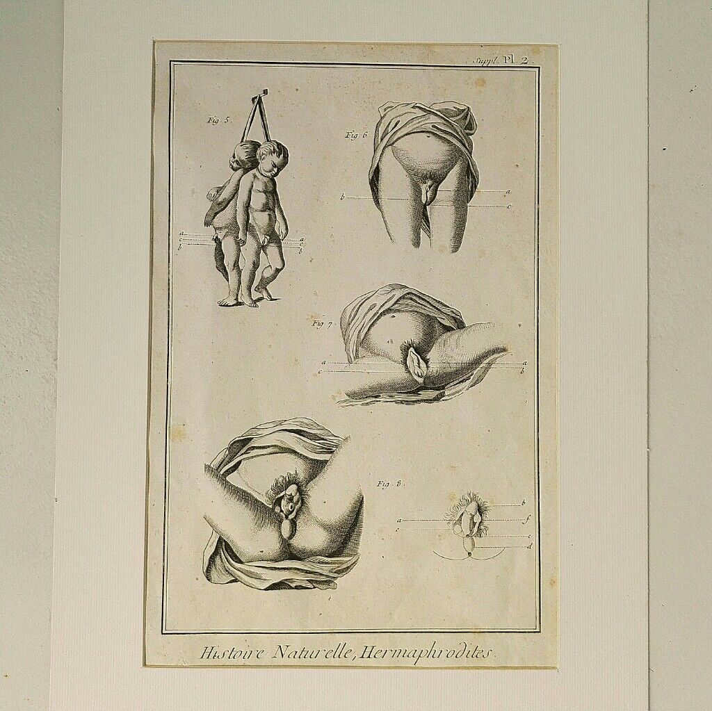 Engravings EIGHTEENth hermaphrodites Diderot cabinet curiosity