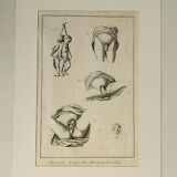 Engravings EIGHTEENth hermaphrodites Diderot cabinet curiosity