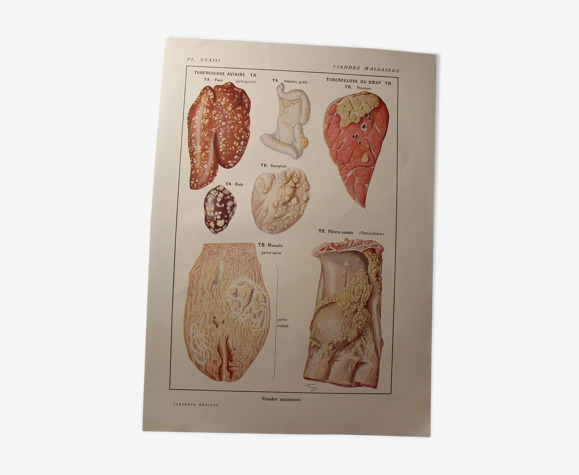 Planche médicale viandes malsaines
