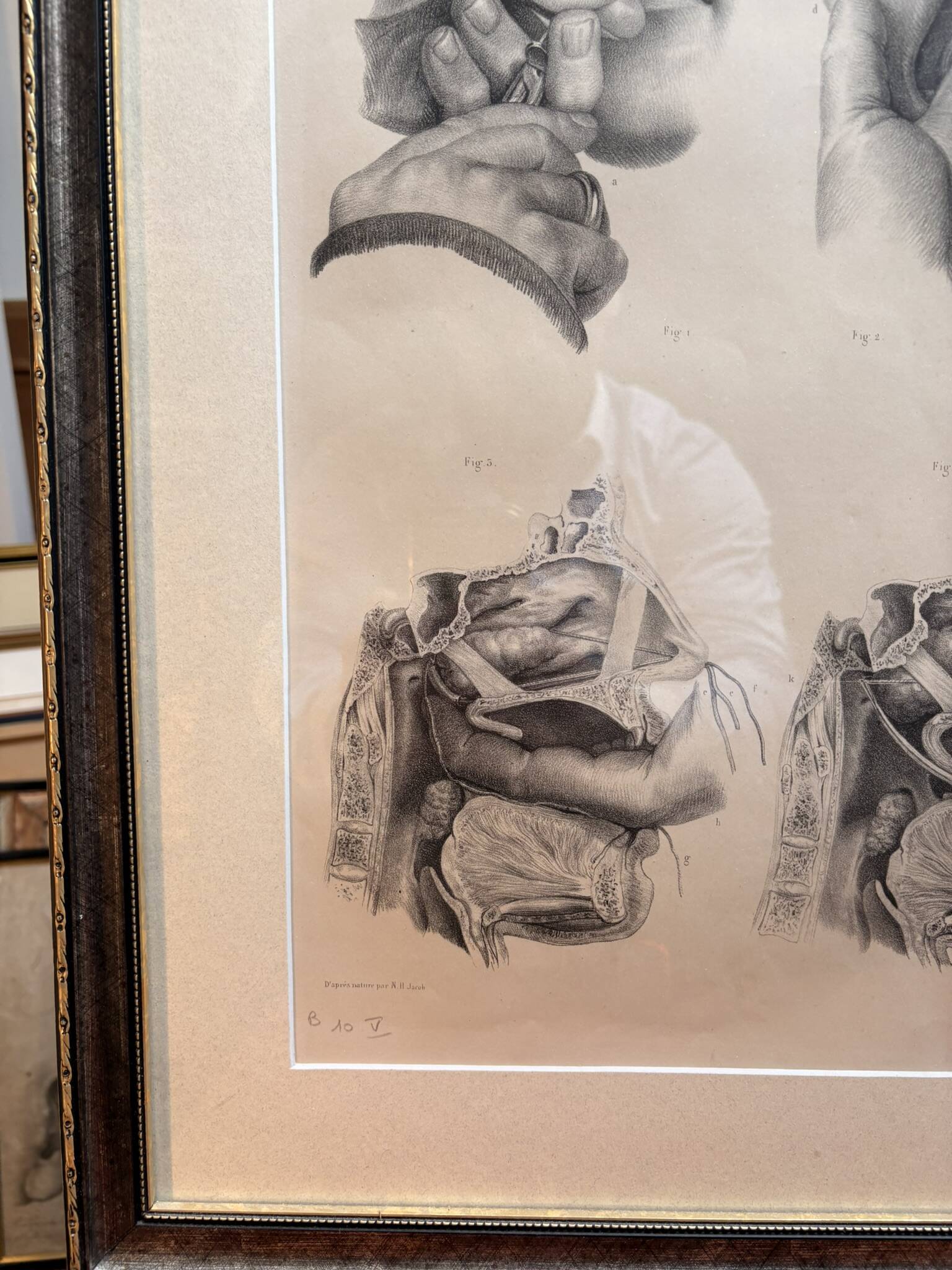 Old Engraving Nose Nasal Cavity NICOLAS HENRI Jacob Bourgery Medical Anatomy