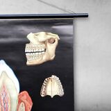 Pull-Down Chart of Human Teeth, 1960s