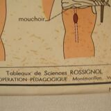 Old school poster Rossignol Bones and joints and accidents 90 cm