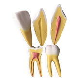Large size dental model 3 teeth
