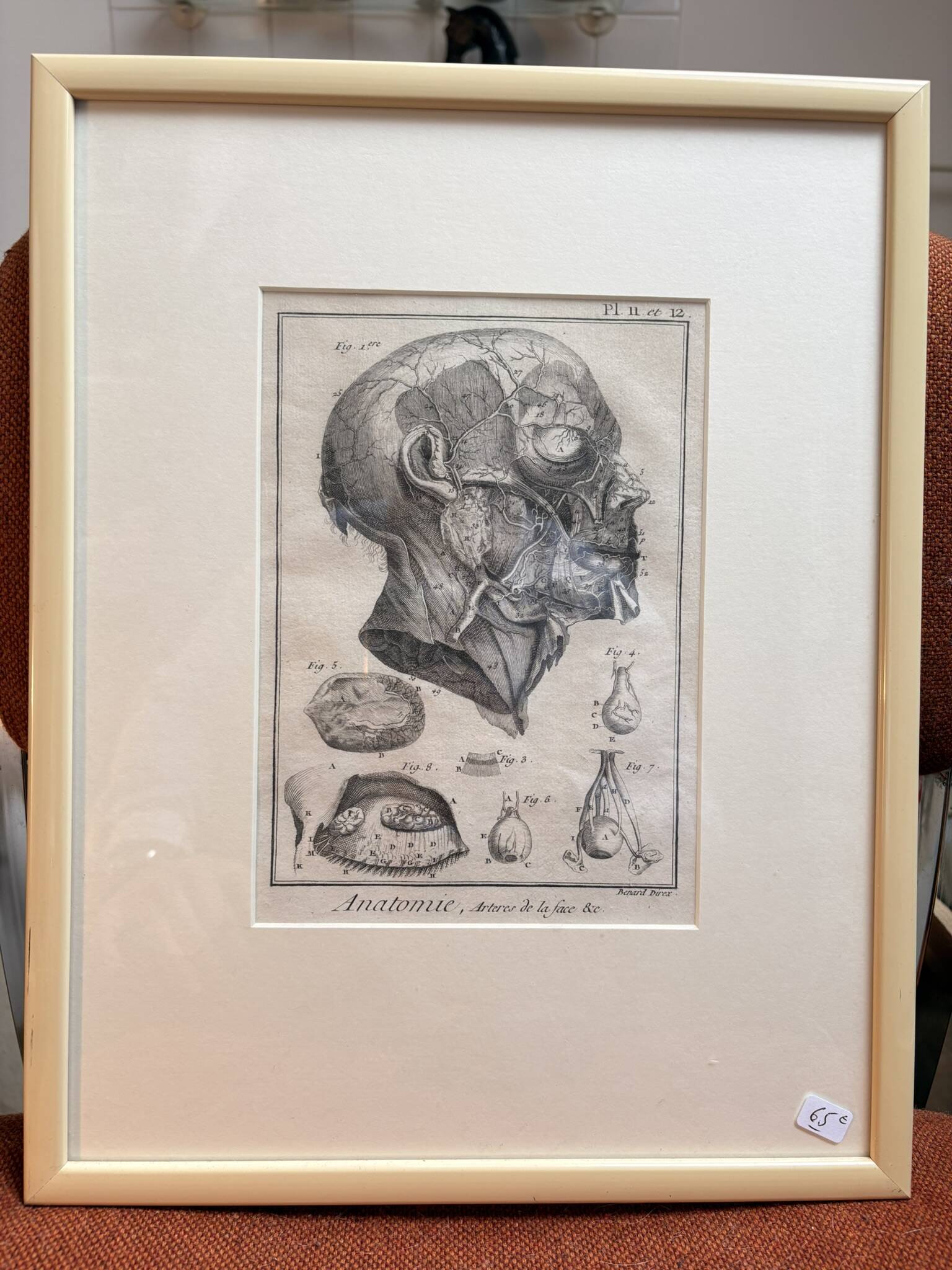 Old Print Engraving 19th Century Framed Anatomy Artery Face Bernard Dixerit