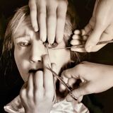 “Schielens Operation (Squint Surgery)” – 1944 Art Photo