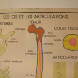 Old school poster Rossignol Bones and joints and accidents 90 cm