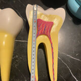 Large size dental model 3 tooth