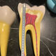 Large size dental model 3 tooth