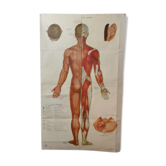 Affiche d'étude d'acupuncture