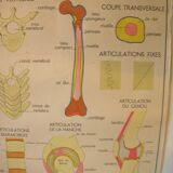 Old school poster Rossignol Bones and joints and accidents 90 cm