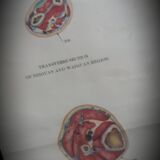 Anatomical poster