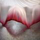Old suspension opaline pink purple serrated handkerchief art deco 1930 TBE