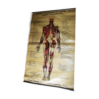 Old "anatomical board" poster