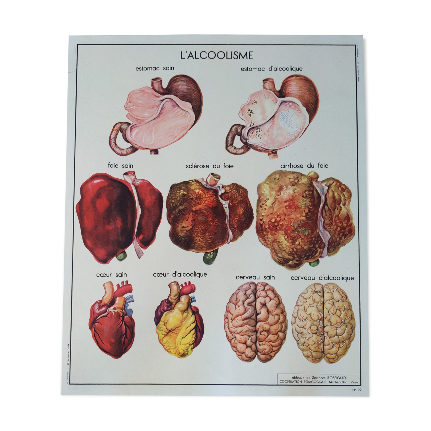 Old vintage school poster nightingale 60s liver alcoholism eye vision