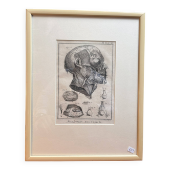 Old Print Engraving 19th Century Framed Anatomy Artery Face Bernard Dixerit