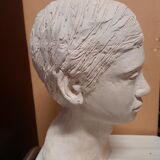 Boy's head in plaster