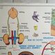 Poster school  excretion & hygiene first aid