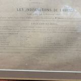 Gravure 19th Century Anatomy Face Woman ANGELO ZAFFONATO "Five Senses"