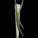 Brass and white opaline wall lights, "Tulip" type, 1950