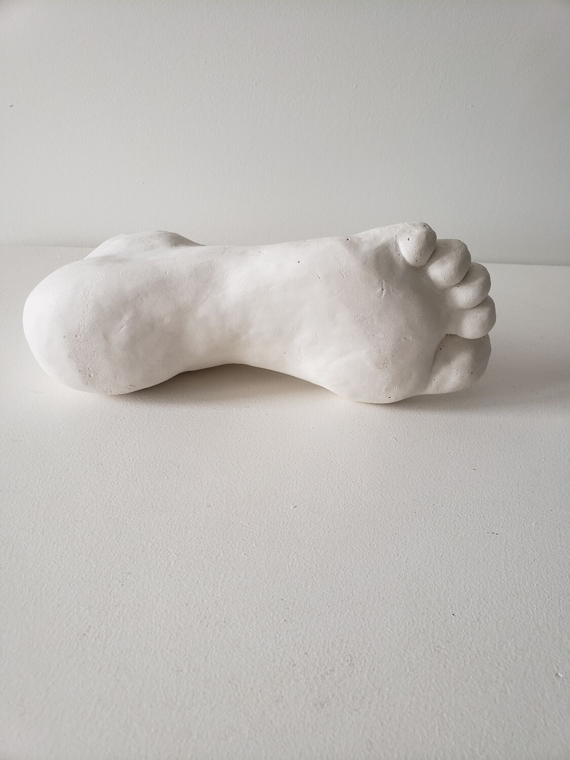 Woman's foot in plaster